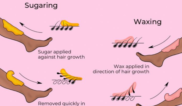 So sánh Sugaring và Waxing